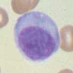 A plasma cell
