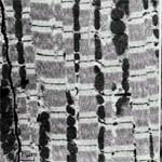 Electronmicrograph.