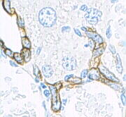 Keratin (high molecular weight) in bile duct cell and oval cells of mouse liver