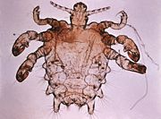 Pubic lice (Phthirus pubis)