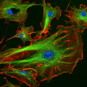 Proteins (red and green stain) at different locations in a cell.
