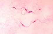 Photomicrograph of Giemsa-stained Trypanosoma cruzi (CDC)