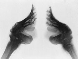 X-ray of bound feet.
