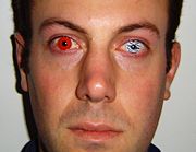 Cosmetic contact lenses