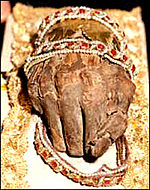 The Holy Right, the right hand of Stephen I.
