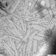 Tobacco mosaic virus (electron micrograph)