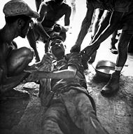 Franco-Vietnamese medicals treating a wounded Viet Minh POW at Hung Yen (1954).