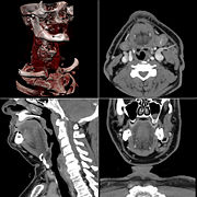 Typical screen layout for diagnostic software, showing one 3D and three MPR views