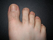 Toenails
