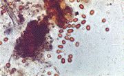 Photomicrograph of particles from red rain sample