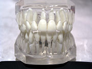 Development of teeth sculpture is a major improvement among dentistry.