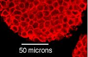 Mouse cells grown in a culture dish. These cells grow in large clumps, but each individual cell is about 10 micrometers across.