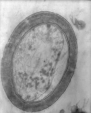 A single grain viewed with a transmission electron microscope, purportedly showing a detached inner capsule.