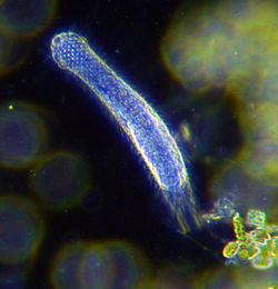 Darkfield photograph of a gastrotrich.