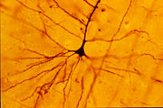 A human neocortical pyramidal neuron stained using the Golgi technique.