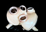 An artificial heart, example of a biomedical engineering.