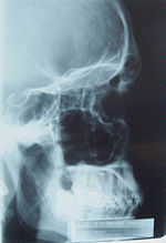 X-Ray Image of a male skull.