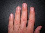 Fingernails
