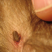Engorged deer tick attached to back of toddler's head. Adult thumb shown for scale.