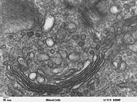 Micrograph of Golgi apparatus, visible as a stack of semicircular black rings near the bottom. Numerous circular vesicles can be seen in proximity to the organelle.