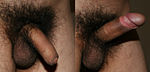 Uncircumcised penis, flaccid (left) and erect (right)