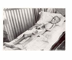 Lizzie van Zyl, shortly before her death in Bloemfontein Concentration Camp