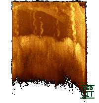 Optical Coherence Tomography tomogram of fingertip, depicting stratum corneum (~500µm thick) with stratum disjunctum on top and stratum lucidum (connection to stratum spinosum) in the middle. At the bottom superficial parts of the dermis. Sweatducts are clearly visible.