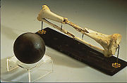 Sickles's leg, along with the cannonball that shattered it, on display at the National Museum of Health and Medicine