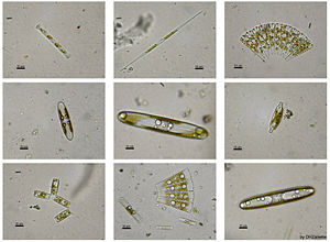Several species of fresh-water diatoms.