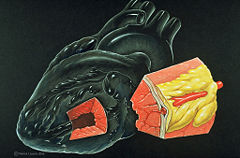 Heart myocardium (heart muscle) and coronary artery