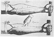 Image of veins from Harvey's Exercitatio Anatomica de Motu Cordis et Sanguinis in Animalibus