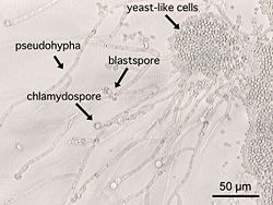 A photomicrograph of Candida albicans showing hyphal outgrowth (a long, branching filamentous cell). Some parasitic fungi like C. albicans use the tip of the hypha to penetrate the host.