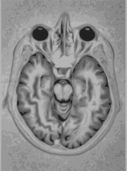 Representation of a brain MRI, an imaging technique used to measure neural activity.