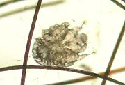 Sarcoptes scabiei var. canis  (dog scabies mite).